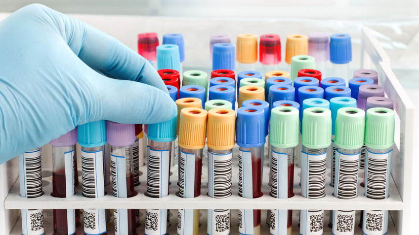 Laboranalysen/Turmormarker